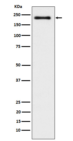 WRN Rabbit mAb