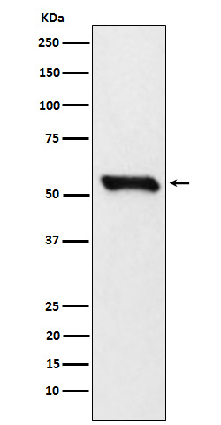 DLDH Rabbit mAb