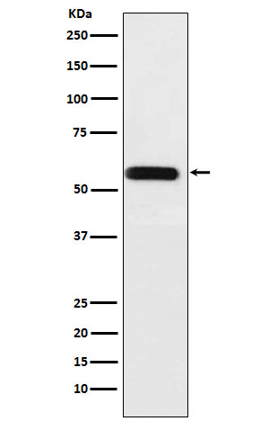 ANGPTL3 Rabbit mAb