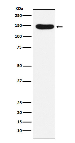 Desmoglein 3 Rabbit mAb