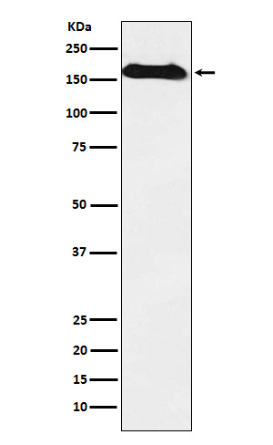 NAIP Rabbit mAb