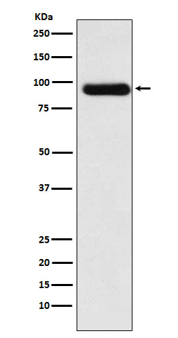 ACVR2A Rabbit mAb