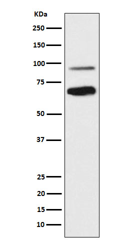 TCF4 Rabbit mAb