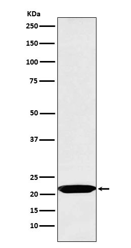 Oncostatin M Rabbit mAb