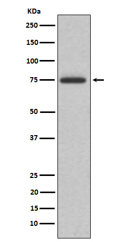 ABI2 Rabbit mAb