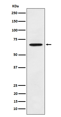 ECM1 Rabbit mAb