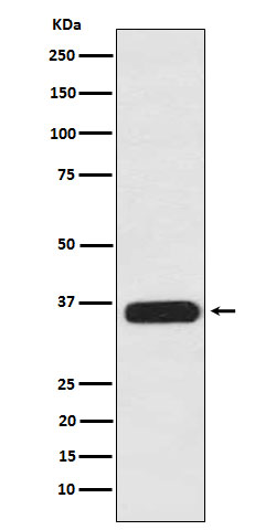 PDLIM1 Rabbit mAb