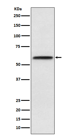 LCAT Rabbit mAb