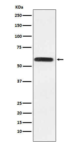 Lgi1 Rabbit mAb