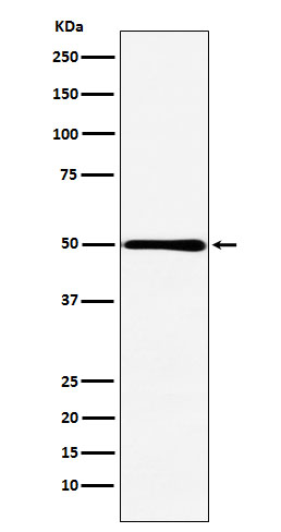 HMGCS2 Rabbit mAb