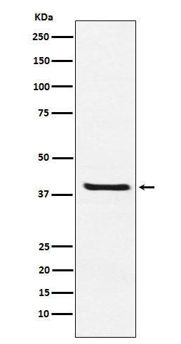 Arg2 Rabbit mAb