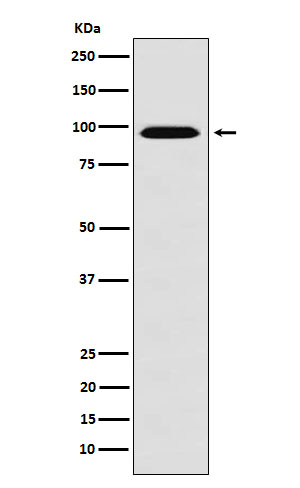 RanBP9 Rabbit mAb