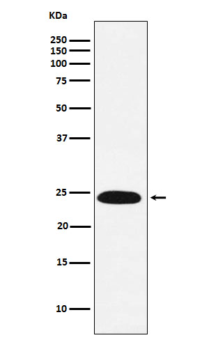 VPS28 Rabbit mAb