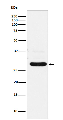 CHMP2B Rabbit mAb