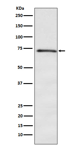 DOK1 Rabbit mAb