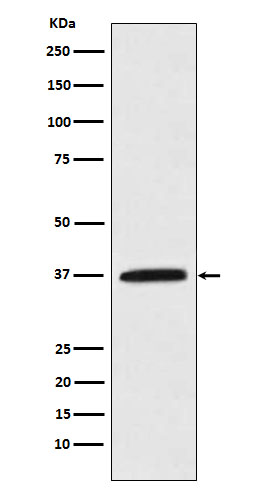 Kallikrein 5 Rabbit mAb