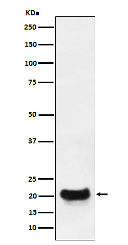 DCTN5 Rabbit mAb