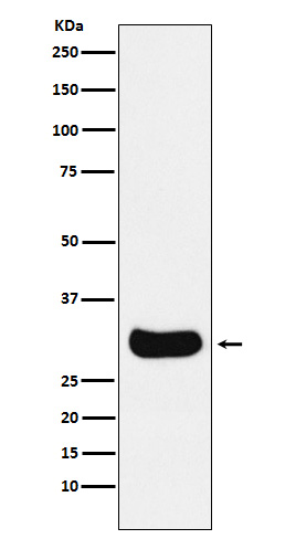 Gemin 2 Rabbit mAb