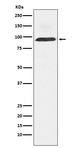 Dynamin 3 Rabbit mAb