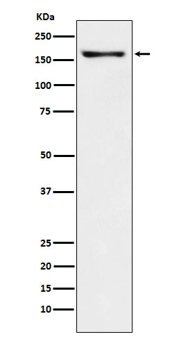 CNTP2 Rabbit mAb