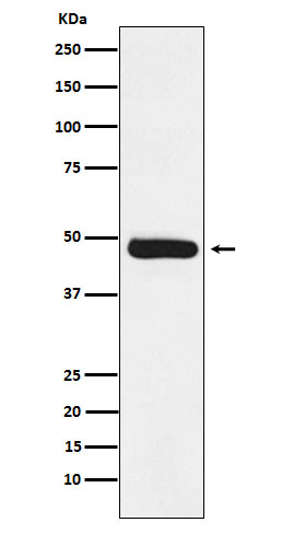 ERCC8 Rabbit mAb