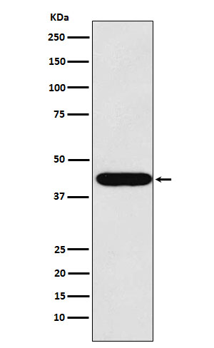 LHX2 Rabbit mAb