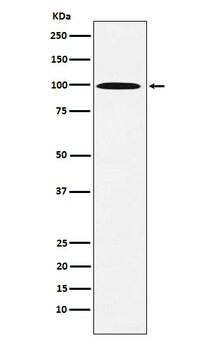 AP1G1 Rabbit mAb