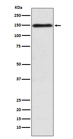 COL11A1 Rabbit mAb