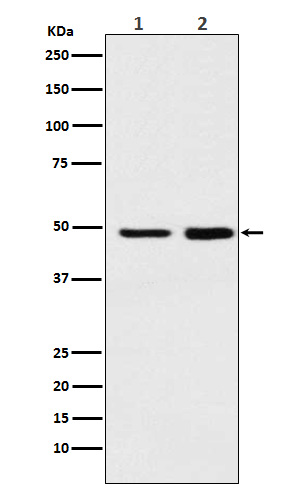 MAT2A Rabbit mAb