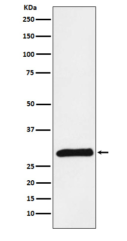 PRSS2 Rabbit mAb