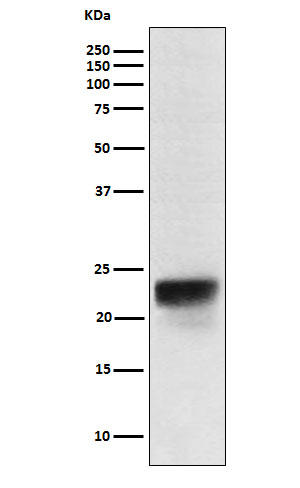 FSH beta Rabbit mAb