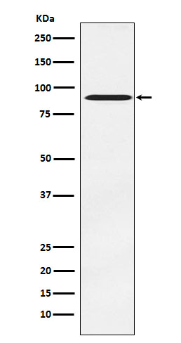 ATRIP Rabbit mAb