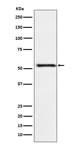 ATP4B Rabbit mAb