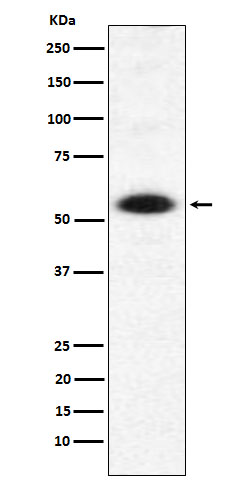 DMAP1 Rabbit mAb