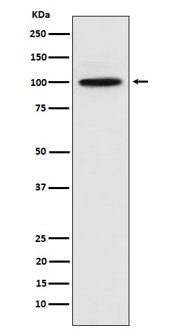 CTNNA3 Rabbit mAb