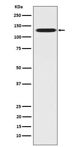 CC2D1A Rabbit mAb