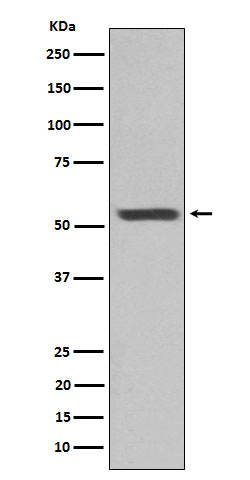 Cytokeratin 12 Rabbit mAb