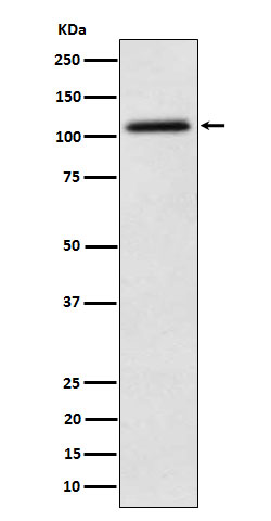 NAT10 Rabbit mAb