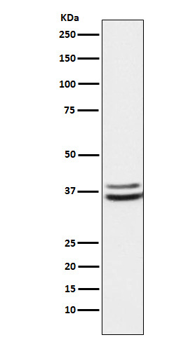 PIM2 Rabbit mAb