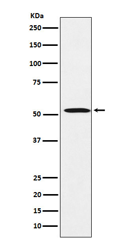 FADS1 Rabbit mAb