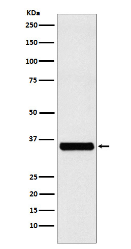 EXOSC7 Rabbit mAb