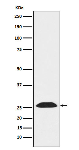 UCHL3 Rabbit mAb