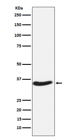 EXOSC7 Rabbit mAb