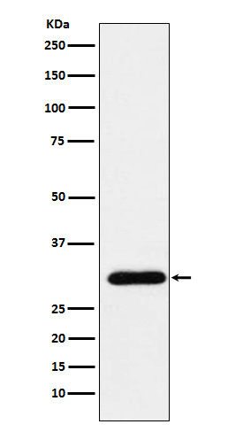 GTF2F2 Rabbit mAb