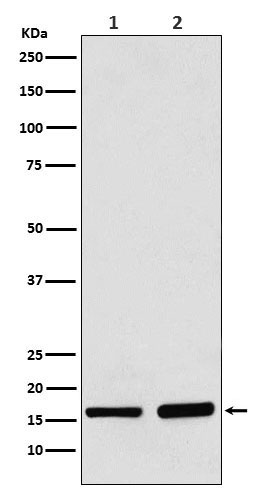 AP2S1 Rabbit mAb