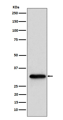 NUDT5 Rabbit mAb