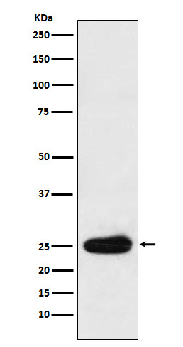 Kappa light chain Rabbit mAb