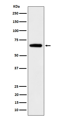 IGF2BP2 Rabbit mAb