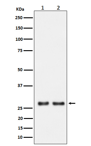 UPP1 Rabbit mAb