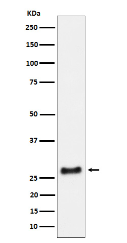 SNRPA1 Rabbit mAb